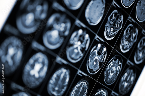 Obraz na płótnie Medical background with MRI scan image of human head w salonie