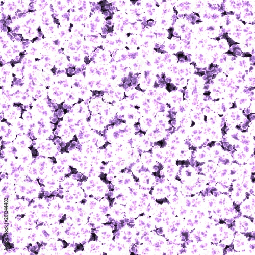 In vitro shot of dangerous bacteries through microscope