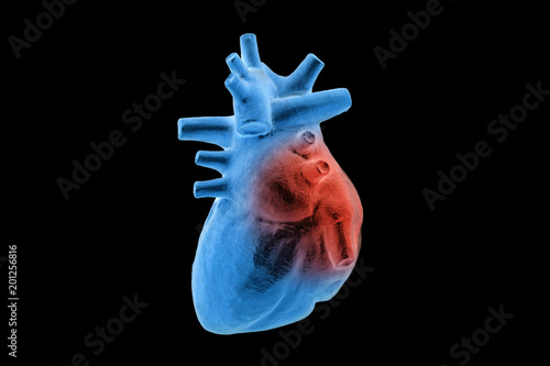 3d rendering of human heart disease on black background