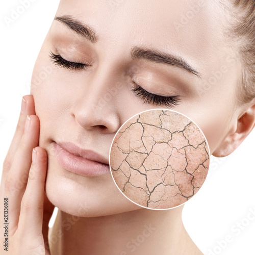 Zoom circle shows dry facial skin before moistening.