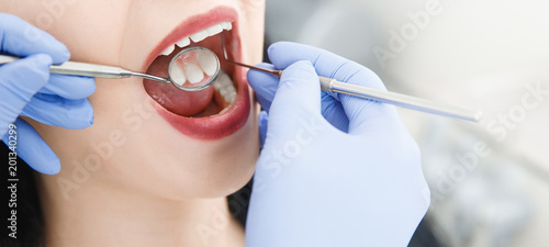 Smiling pretty woman is having her teeth examined by dentist in clinic. Concept of caries treatment