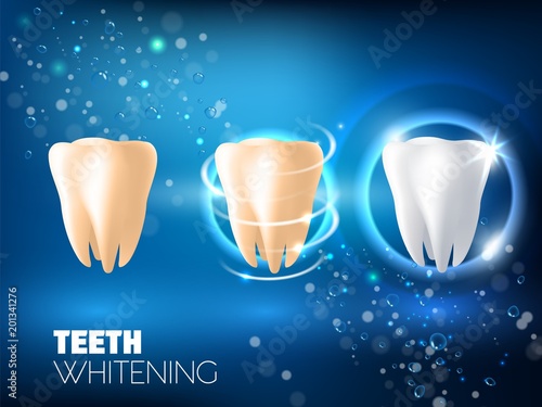 Teeth whitening ad vector realistic illustration