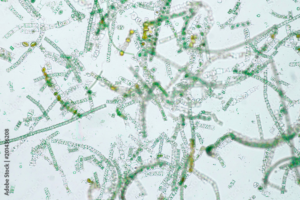 Filamentous algae are single algae cells that form long visible chains Filamentous algae are single algae cells that form long visible chains