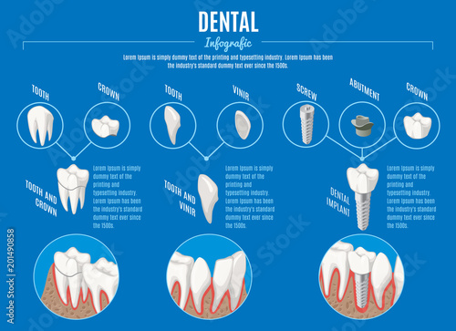 Isometric Prosthetic Dentistry Infographic Concept