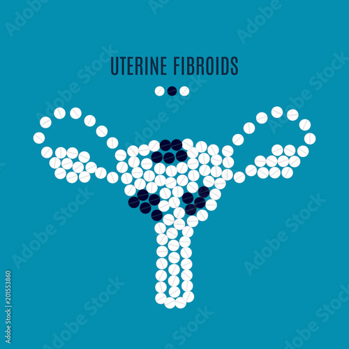 Uterine fibroids awareness poster with uterus made of pills on blue background. Medical solidarity concept for gynaecological clinics and maternity centers. Human body organ icon. Vector illustration.