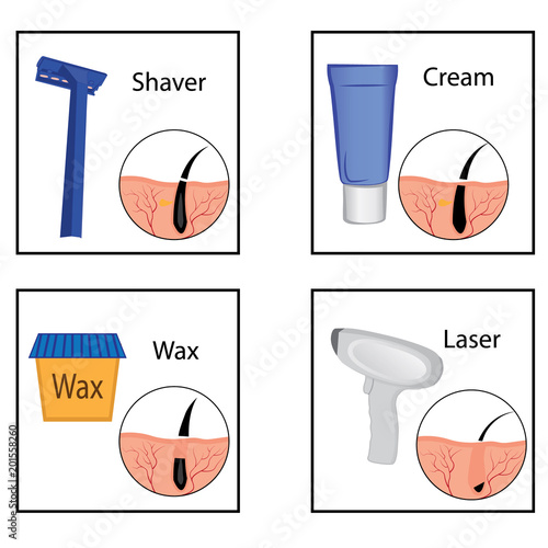 4136097 Hair removal methods and its result  vector illustration