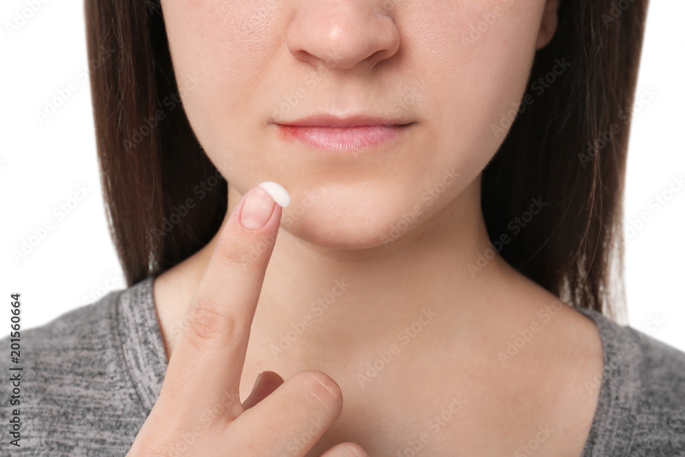 Young woman applying cold sore cream on lips, closeup Young woman applying cold sore cream on lips, closeup