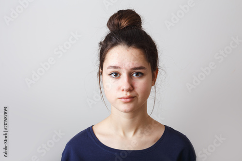 portrait of a pimply teenage girl in a blue T-shirt on a gray background  sad doubting face