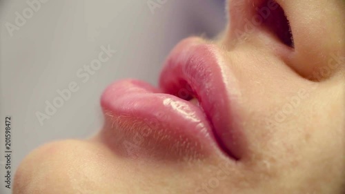 Lip injection plastic surgery. Close up lips of patient during lip augmentation