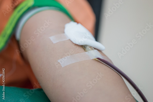 Health and Medical, Needles pierce vein in arm for blood donor at donation. Blood donation occurs when person voluntarily has blood drawn used for transfusions. Image for World blood donor day June 14