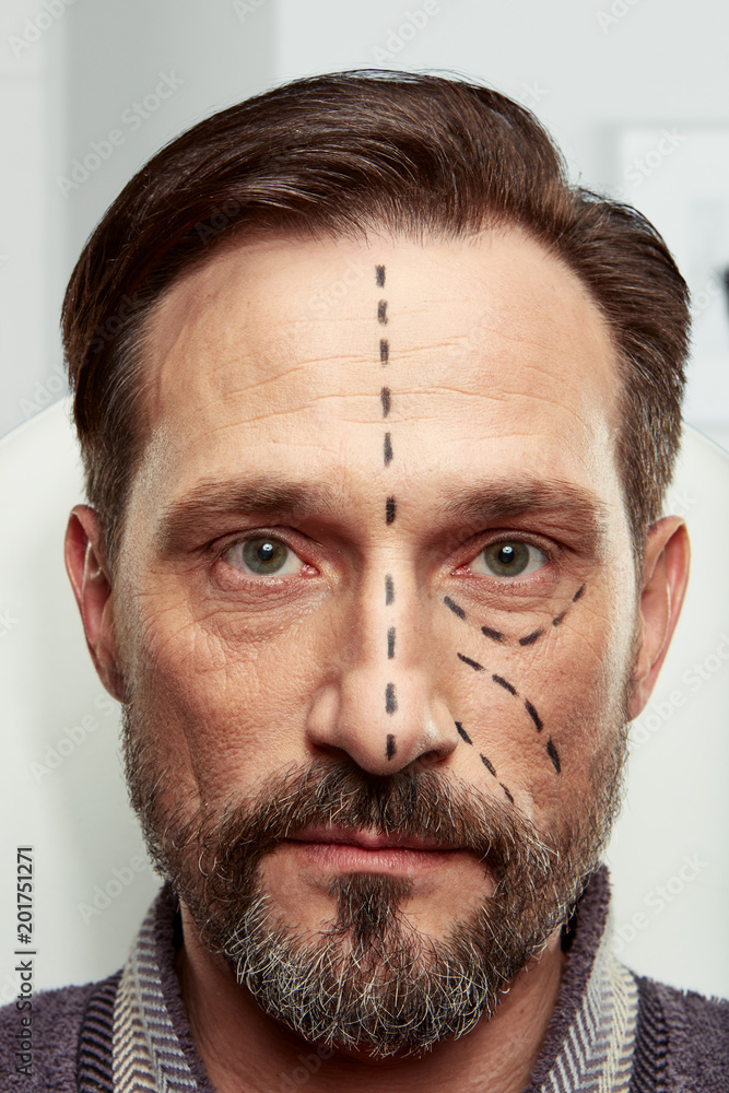 One day in the clinic of aesthetic medicine