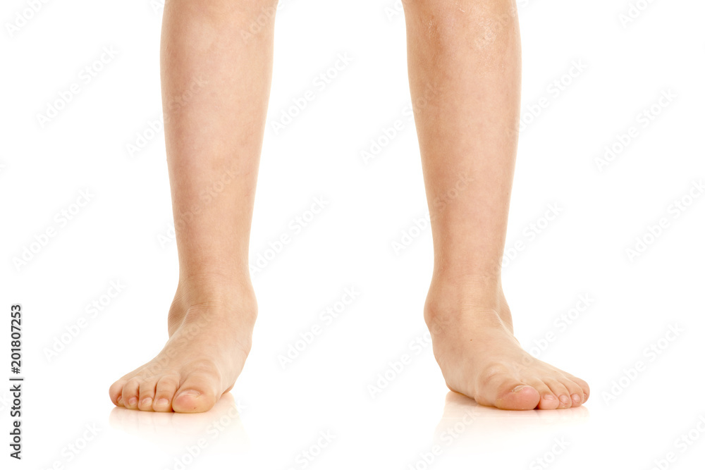 Closeup of naked little boy with valgus deformity of legs Stock Photo