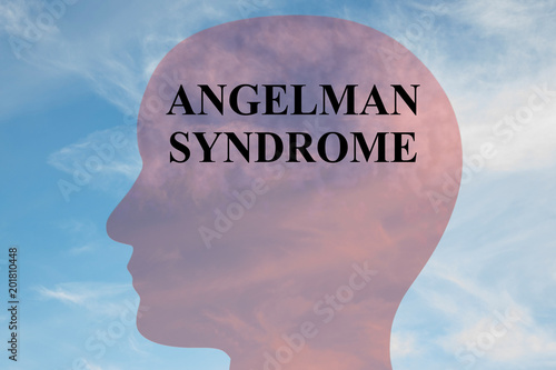 ANGELMAN SYNDROME concept photo