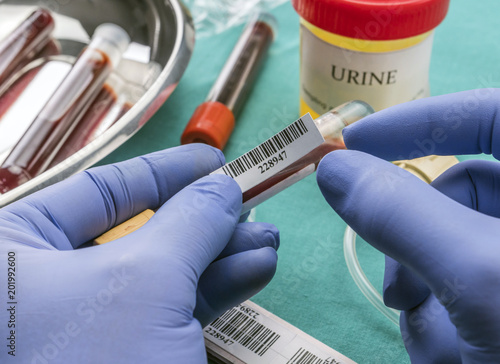 фотографія Doctor holds blood sample at a hospital table, conceptual image