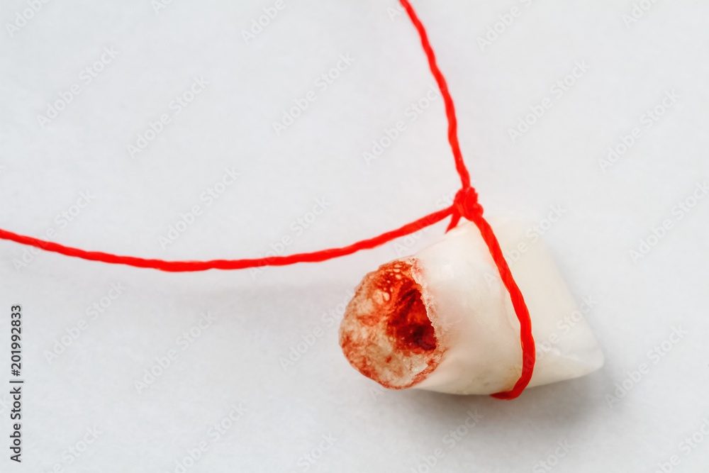 Extracted baby tooth tied with a red thread on light background. Closeup, selective focus
