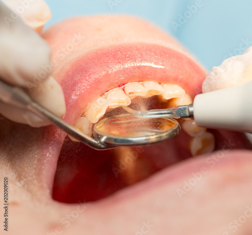 Fototapeta Naklejka Na Ścianę i Meble -  A dentist makes teeth to a woman
