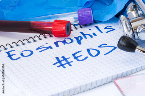 Eosinophils count procedure (Eos) white blood cell test. Laboratory test tubes with blood, stethoscope, smear or film and gloves are near note with text Eosinophils (Eos) on table in doctor office photo