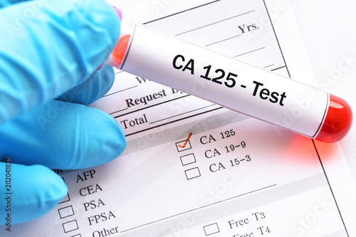 Blood sample for CA125 test, tumor marker for ovarian cancer photo