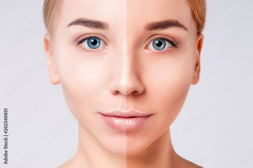 Fototapeta premium Woman face portrait with half tan skin. Beauty Portrait. Beautiful Spa model Girl with Perfect Fresh Clean Skin. Blonde female looking at camera. Youth and Skin Care Concept.