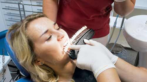 Closeup image of dentist matching patients teeth color with special checker