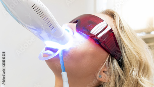 Closeup image of special UV light lamp for teeth whitening in patients mouth photo