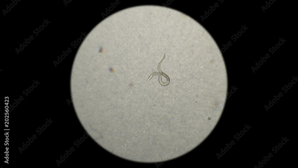 the nematode worm under a microscope the nematode worm under a microscope