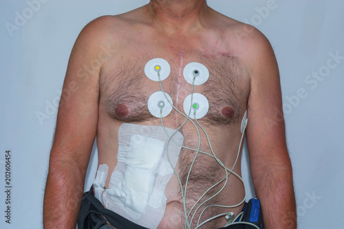 Upper body of a man with ECG electrodes photo