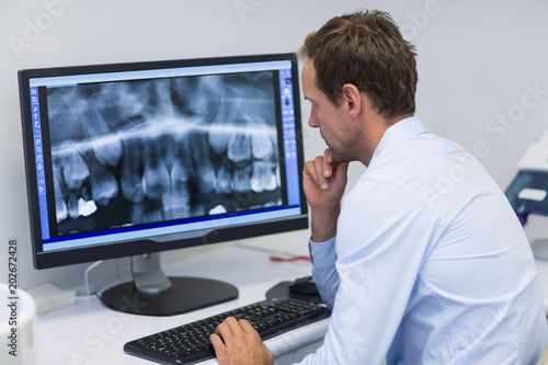 Dentist examining an x-ray on computer in dental clinic photo