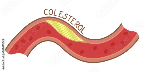 cholesterol illustration, cholesterol word in spanish
