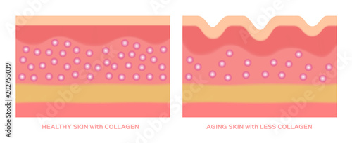 collagen in younger skin and aging graphic