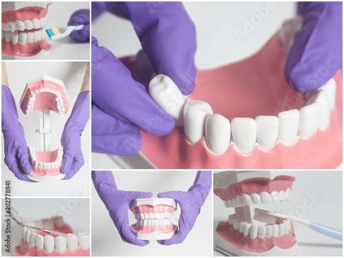 Teeth human model.Dental care concept.Collage photo