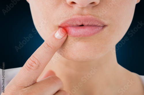 Woman pointing her lips against blue background with vignette