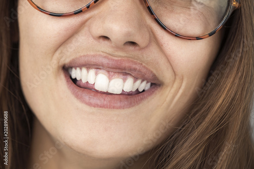 Closeup of smile with white healthy teeth