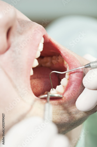 Close up of a dental procedure