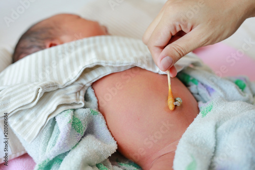 Clean the umbilical cord baby 7 days old.
