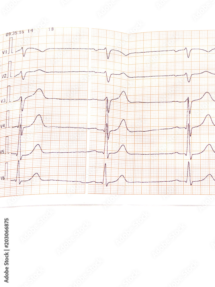 Close the electrocardiogram in paper on white isolated background