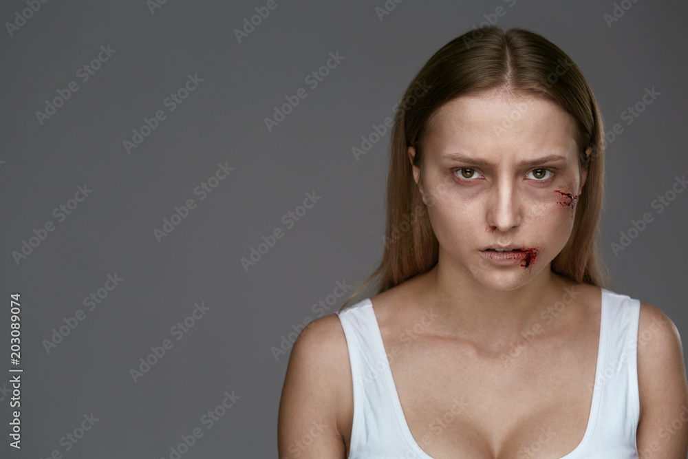 Domestic Violence. Woman With Beating On Face Domestic Violence. Woman With Beating On Face