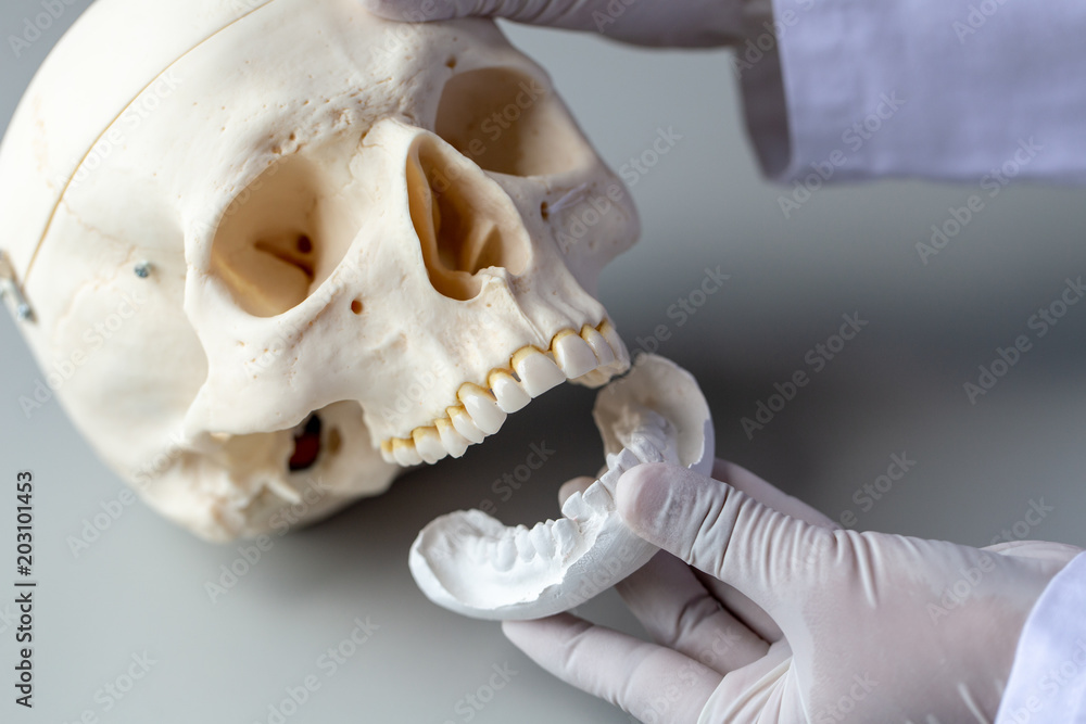 Study cast of Diagnostic cast and dental gypsum models in dental