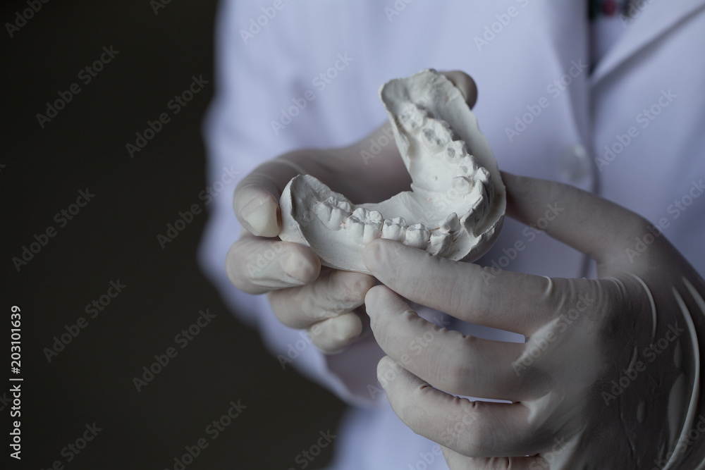 Study cast of Diagnostic cast and dental gypsum models in dental