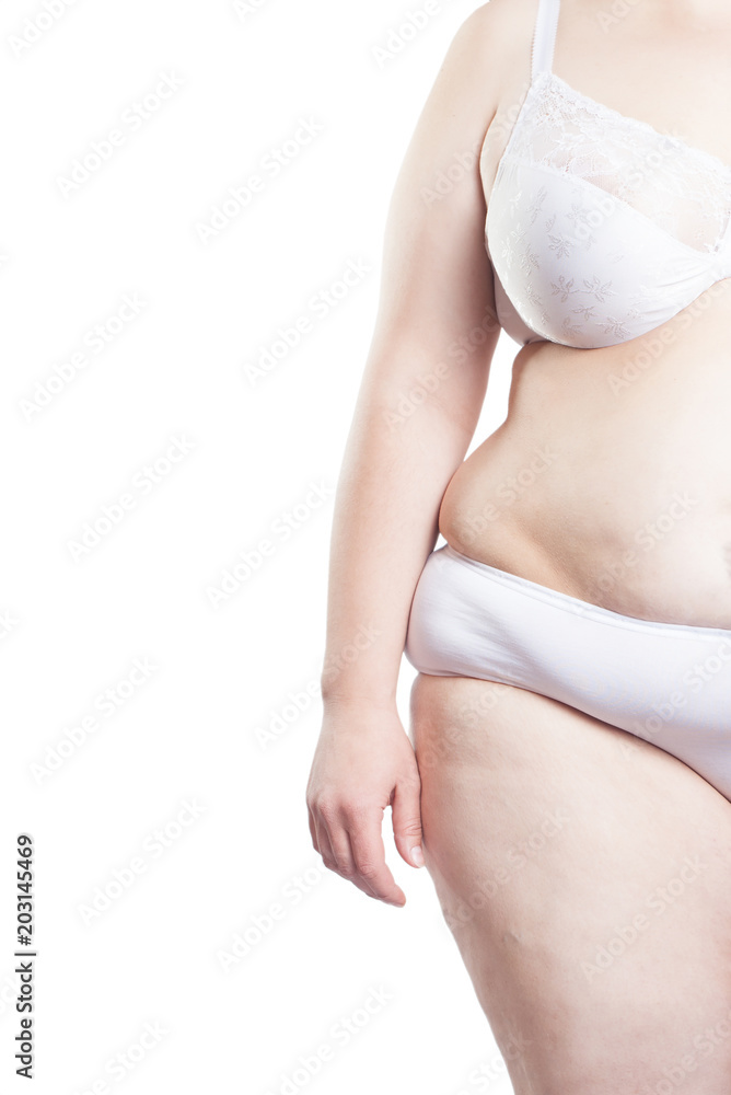 woman with overweight, obesity (overweight, obesity)