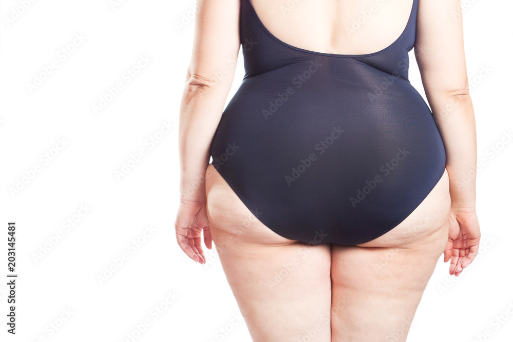 fat woman in a swimsuit turned with her back ( overweight, obesity