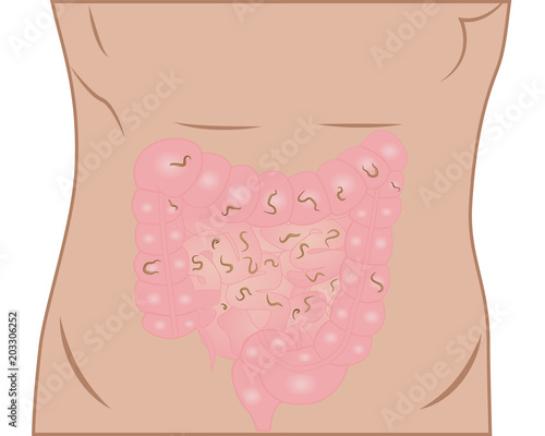 helminths in  intestine
