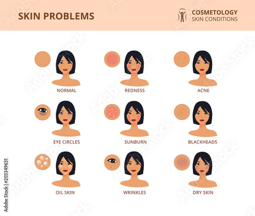 The most common female facial skin problems: acne, wrinkles, dry skin, dark circles, blackheads and oil skin. Dermatology poster with asian woman face