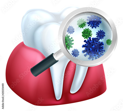 Magnifying Glass Tooth Bacteria Concept