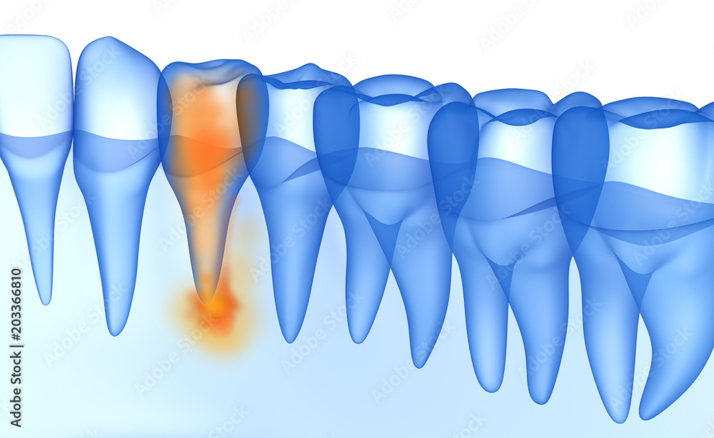 Mouth gum and teeth xray view. Teeth problem. Medically accurate tooth 3D illustration Mouth gum and teeth xray view. Teeth problem. Medically accurate tooth 3D illustration