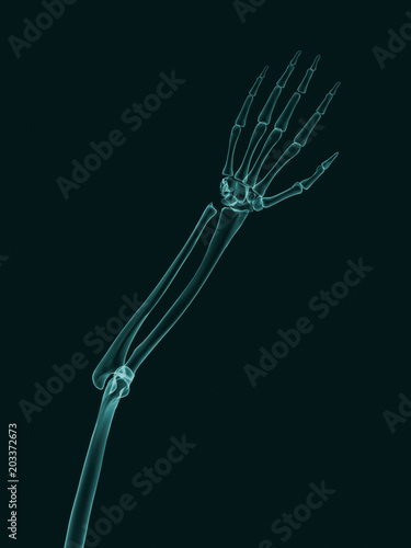 X-Ray effect image of human arm