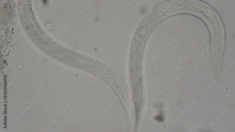 Stockvideon parasite Strongyloides stercoralis from human feces under