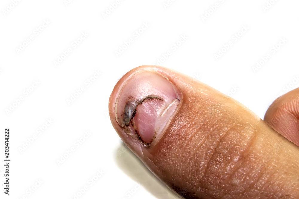 Crop person with bleeding wound on finger · Free Stock Photo