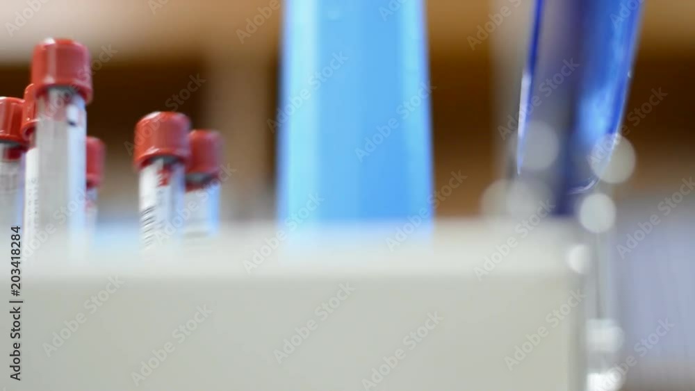 test tube in laboratory for analysis or researching test tube in laboratory for analysis or researching
