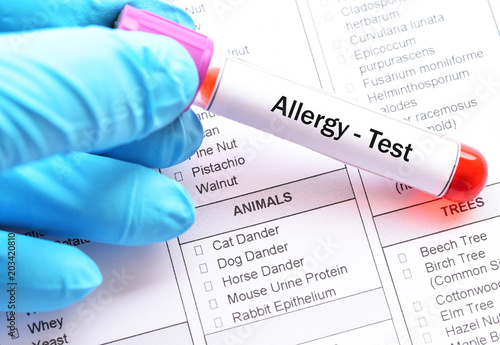 Test tube with blood sample for allergy profile test